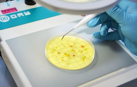 Testung Petrischalen mit Nährboden 3 - vergrößerte Ansicht laden
