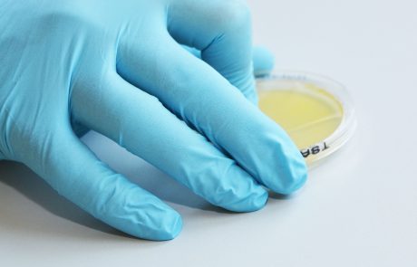 Blue gloves with petri dish and nutrient medium- load enlarged view